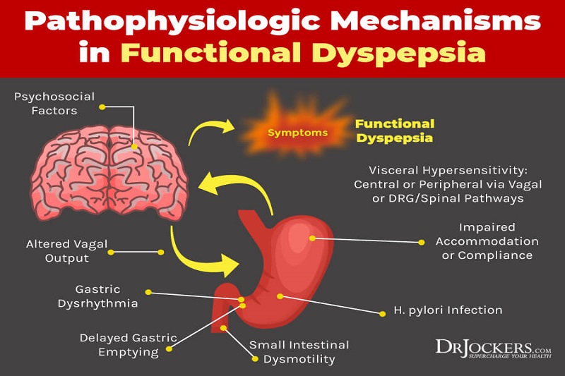 Dyspepsia2