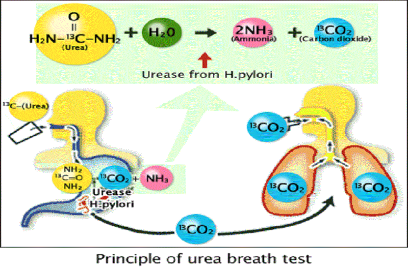 co-che-test-tho-kiem-tra-hp