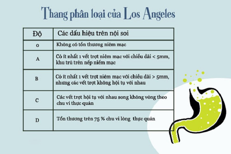 phân loại trào ngược