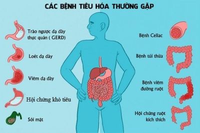 Các bệnh tiêu hóa thường gặp: Viêm dạ dày, viêm đại tràng, trào ngược,...biểu hiện triệu chứng, phương pháp điều trị. Nội soi chẩn đoán, phát hiện sớm, chi phí nội soi